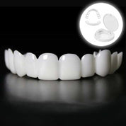 Instant smile transformation with Snap-on Smile Veneers 0