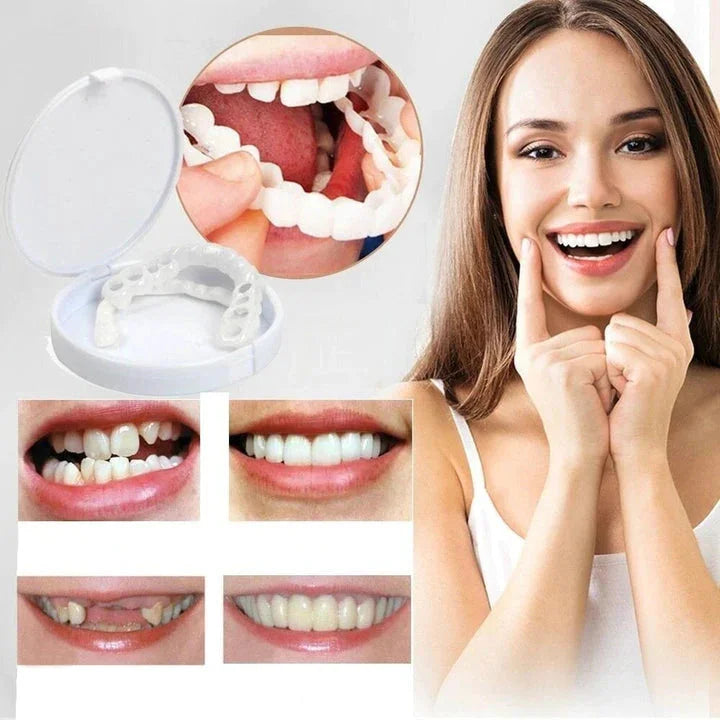 Instant smile transformation with Snap-on Smile Veneers 1