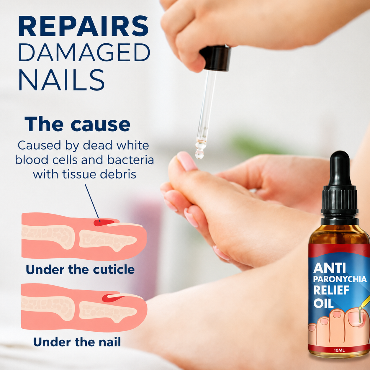 Reparatur beschädigter Nägel | Eingewachsene Nägel & Nagelbett | Hände & Füße | KeraSeal 1